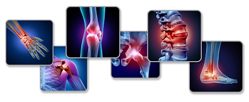 orthobiologics can promote tissue healing to eliminate joint pain